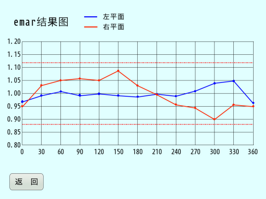 高精度平衡机